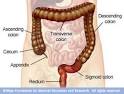 Clostridium difficle (C. DIFFICILE) « Primum non nocere