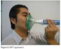 nasal obstruction (Figure