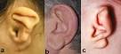 http://elementsofmorphology.nih.gov/images/terms/Question_Mark_Ear-large.jpg