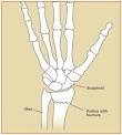 <b>Wrist</b> bones shown with a