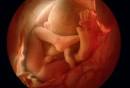 Fetal Development | Pregnancy Resource Center