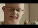Meet Nick: Rhabdomyosarcoma