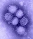 H1N1 vaccine not a high risk for Guillain-Barre syndrome | Vaccine ...