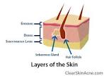 oily skin? how do i take care of it? | regenna's Blog