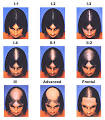 Hair Loss | Causes of Hair Loss | Viviscal