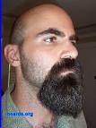Bald Guys with Beards