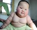 Prader-Willi Syndrome Causes Unstoppable Appetite: Ever heard of it?