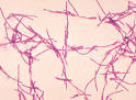 FBI releases documents on Bruce Ivins | BioPrepWatch.