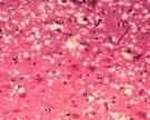 New Tests Identify Lethal Prion Strains Quickly And Accurately