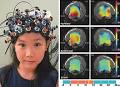 Les interfaces cerveau/ordinateur non invasifs ont le vent en ...