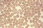 <b>Babesiosis</b> - Animals Voice Romania