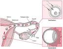 Fallopian tube