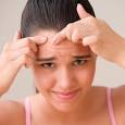 What Causes Acne Vulgaris | Anti-Aging Anti-Wrinkle Creams