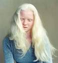 The Beauty of Albinism - ABC News