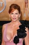 Melissa Gilbert Plastic Surgery - Detail