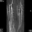 periphere MR-<b>Angiographie</b>