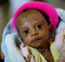 ... Dili-based American doctor Dan Murphy thinks baby Maria Dos Santos will ... - svMARIA_wideweb__470x448,0