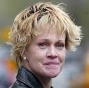 Melanie Griffith Underwent a Skin Surgery - melanie-griffith