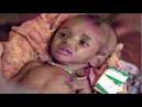 East Africa Hunger Crisis -