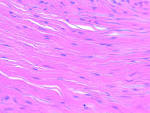 Dense Regular <b>Connective Tissue</b>