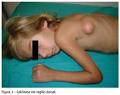 referia fraqueza <b>muscular</b>,