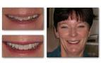 General Dentist : Henderson Nevada : Patrick Simone, DDS, MAGD - gallery14