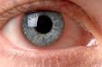 <b>Iritis</b> Symptoms