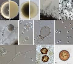 Image result for Mucor circinelloides forma lusitanicus