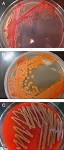 <b>Serratia Infections</b>: from Military Experiments to Current Practice