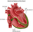 Weill Cornell Cardiology - Cardiac Electrophysiology Studies