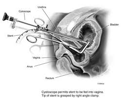 http://t1.gstatic.com/images?q=tbn:ANd9GcRLl_NhiTfFJr1MQTD8Hpw-Z6GT6IbtDzoYyUuUnU7uOybHgS1TiQ