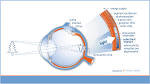 <b>Retina</b> Implant AG