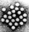 NOROVIRUS assumed at Scots boarding house | TopNews Singapore