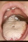  Pregnant Having a Candidiasis &raquo; Submit Your Best Article