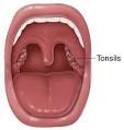 SECOND SCOOP: ICE CREAM AFTER TONSIL REMOVAL – FACT OR FICTION ...