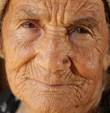  Wrinkles | Health Dictionary