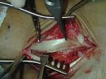 During the <b>injury</b>, the foot