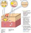 All Stop Poison Ivy Treatment and Relief Information :: New ...