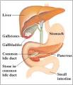 Understanding <b>Pancreatitis</b>