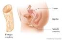 Female Condom Demonstration :