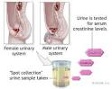 <b>Creatinine</b> clearance