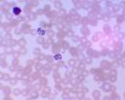 <b>Plasmodium vivax</b>