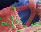 What is HIV/