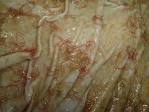 ديدان هيومنكس <b>Haemonchus</b>