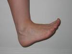 Foot &amp; Ankle Exercises
