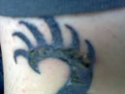 infected tattoo-11