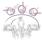 Benign paroxysmal positional vertigo - Treatment - Step-by-step ...
