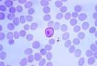 parasite <b>Plasmodium vivax</b>