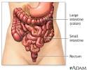 Home Remedies For Flatulence
