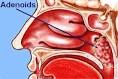 Picture and anatomy of the Adenoids - OTOLARYNGOLOGY HOUSTON